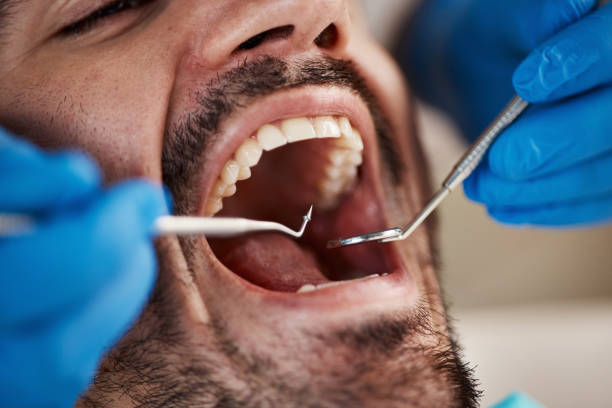 Best Emergency Cosmetic Dentistry (e.g., broken veneers) in London, KY
